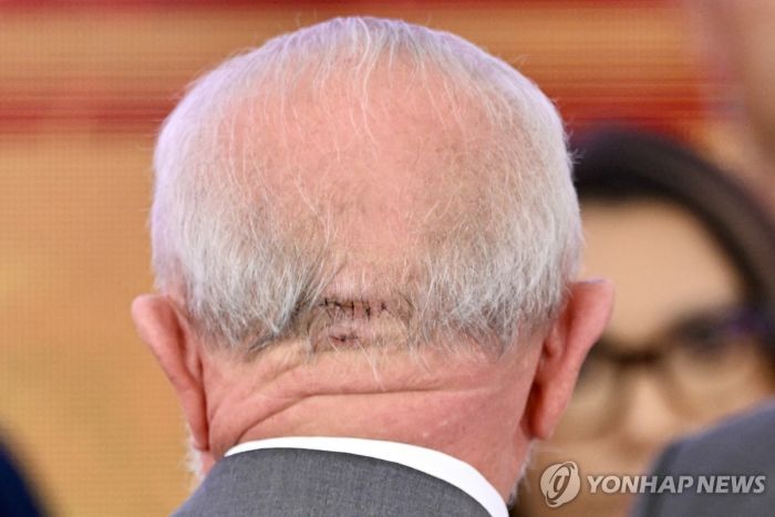 브릭스 가입절차 무산 베네수, 브라질 비난…"룰라 부상은 꾀병"